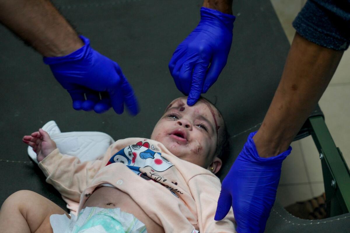 طفل فلسطيني أصيب في القصف الإسرائيلي لقطاع غزة يتلقى العلاج في مستشفى في دير البلح في 14 نوفمبر 2023. — AP
