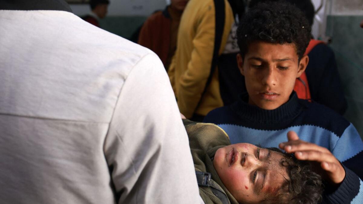 طفل صغير يداعب رأس أحد ضحايا القصف الإسرائيلي في مستشفى النجار برفح.  – وكالة فرانس برس