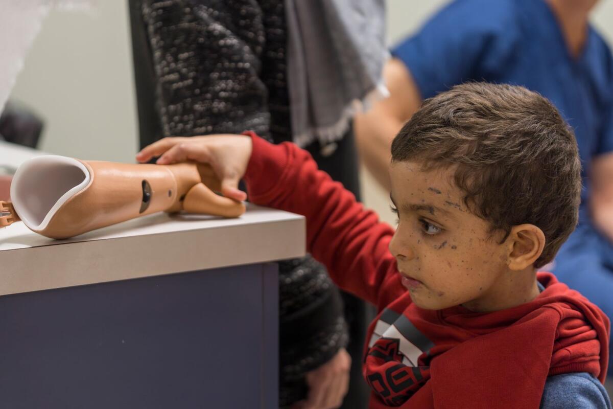 عمر أبو كويك، البالغ من العمر أربع سنوات، يفحص ذراعه الاصطناعية الجديدة في مستشفى شرينرز للأطفال في 28 فبراير 2024، في فيلادلفيا.  — ا ف ب